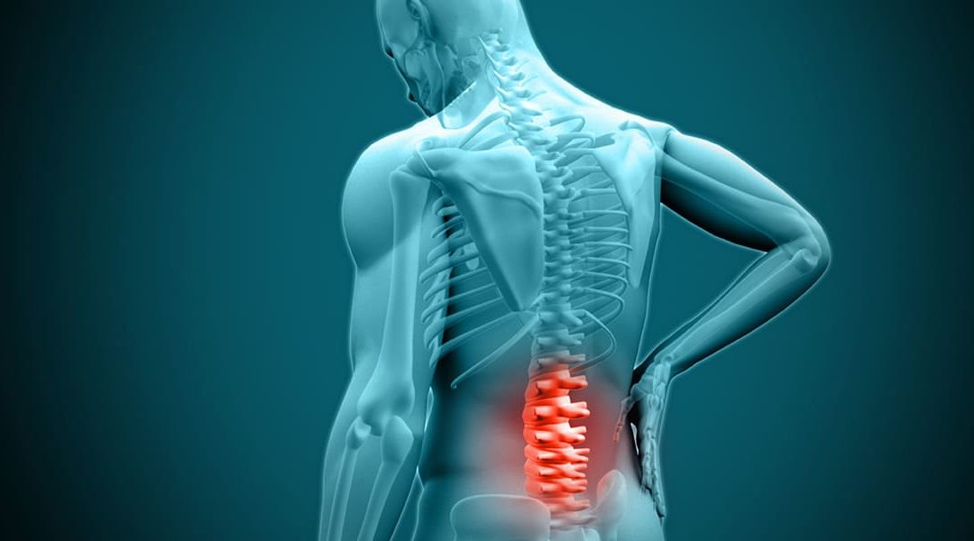 Suffering From a Herniated Disc? - Spine Surgery - Lumbar Disc Herniation